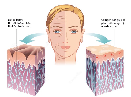 Nên uống collagen loại nào tốt an toàn nhất