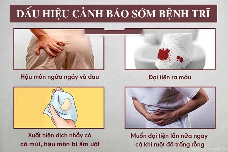 Nguyên nhân của bệnh trĩ ngoại là gì và cách phòng bệnh ra sao