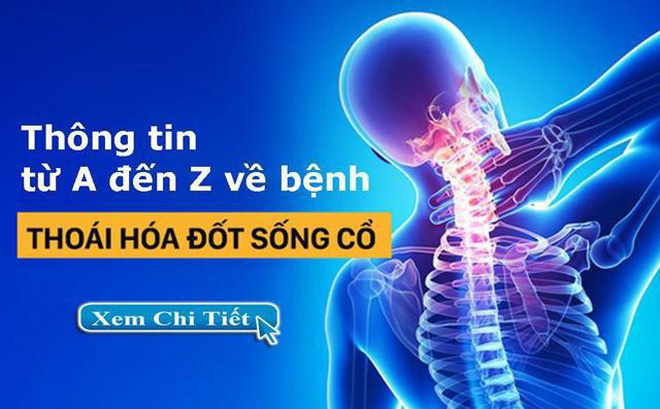 nguyên nhân thoái hóa đốt sống cổ là gì và cách điều trị ra sao