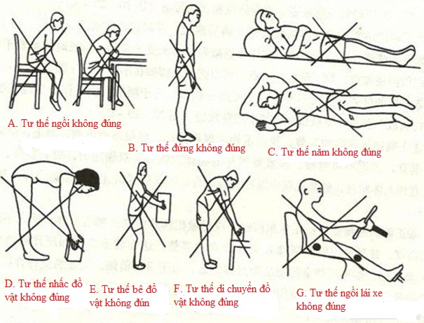nguyên nhân thoái hóa đốt sống cổ là gì và cách điều trị ra sao
