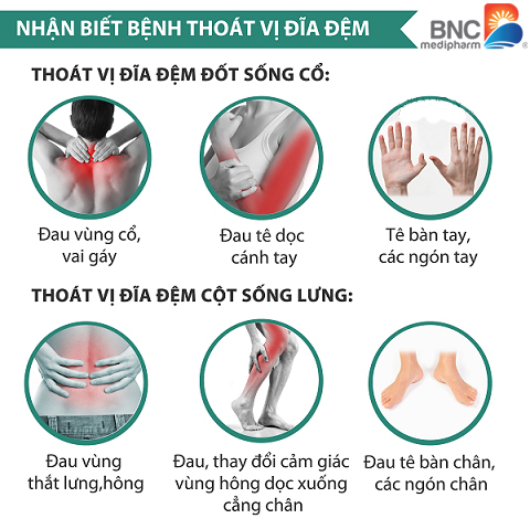 nguyên nhân thoát vị đĩa đệm cột sống