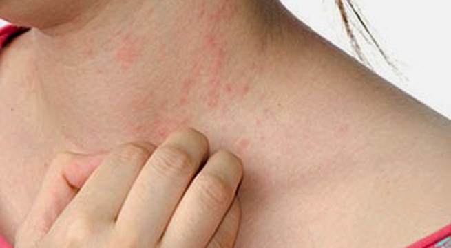 Nguyên nhân ung thư gan là gì và cách phòng bệnh ra sao