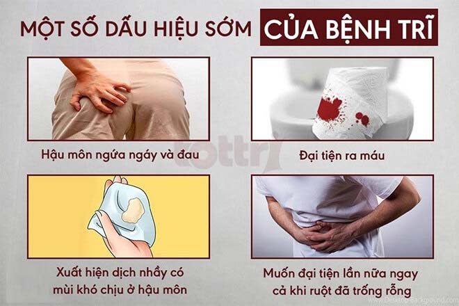 Nguyên nhân và biểu hiện của bệnh trĩ như thế nào