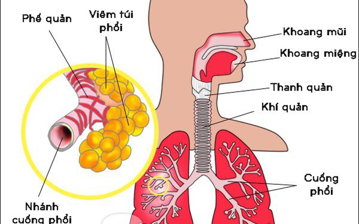 Nhiễm trùng đường hô hấp nên ăn gì