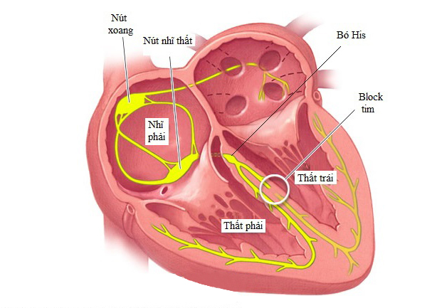 Nhịp tim đập chậm có nguy hiểm không và cách khắc phục