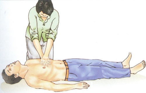 Nhồi máu cơ tim có chữa được không và cách chữa trị như thế nào