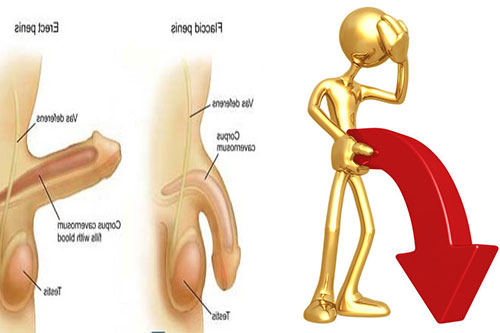 Phẫu thuật rối loạn cương dương như thế nào 