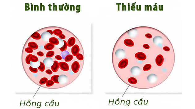 Rối loạn kinh nguyệt có nguy hiểm không