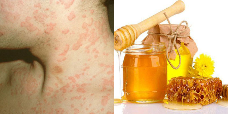 Rửa mặt bằng mật ong hàng ngày có tốt không và cách dùng như thế nào