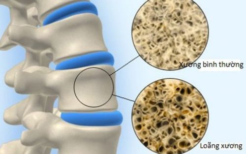 Sữa ong chúa dạng viên có tốt không?