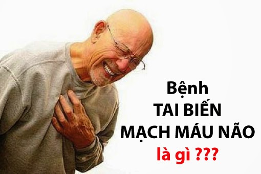 bệnh tai biến mạch máu não là gì