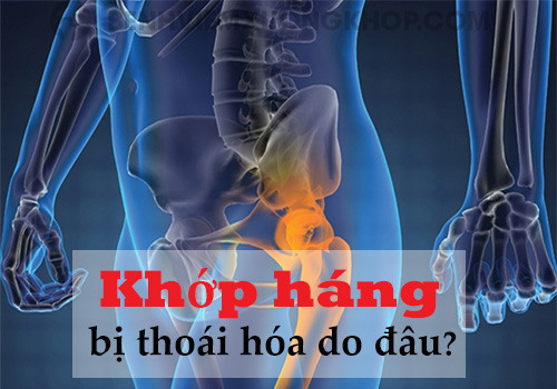 Thoái hóa khớp háng - Nguyên nhân triệu chứng và cách phòng điều trị bệnh