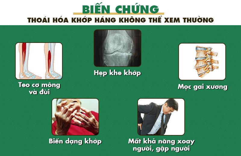 Thoái hóa khớp háng - Nguyên nhân triệu chứng và cách phòng điều trị bệnh