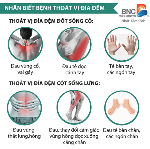 thoát vị đĩa đệm