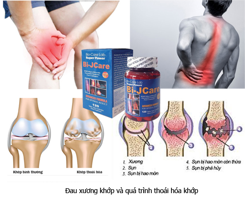 thực phẩm chức năng nào tốt cho xương khớp hiện nay