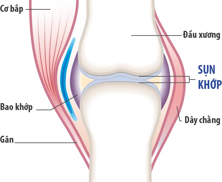 Thực phẩm chức năng tái tạo sụn khớp tốt nhất hiện nay