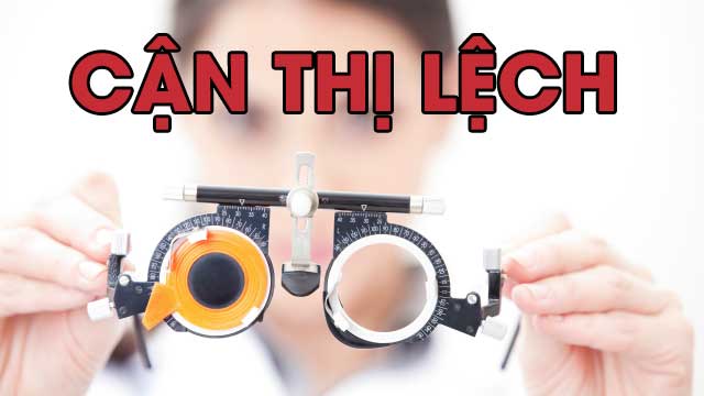 Thuốc bổ mắt cho người cận thị tốt nhất hiện nay