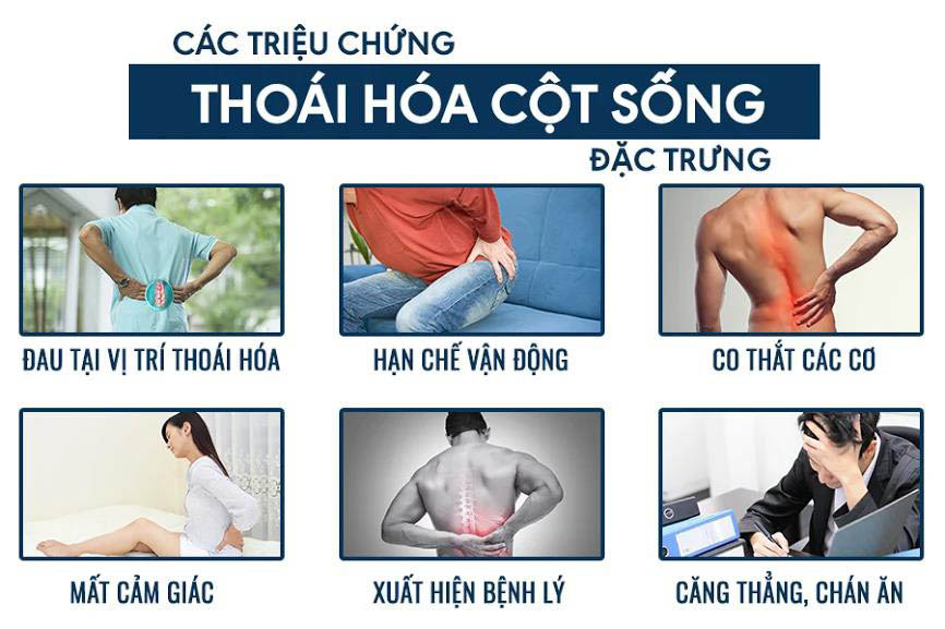 Thuốc chữa thoái hóa đốt sống cổ an toàn hiệu quả