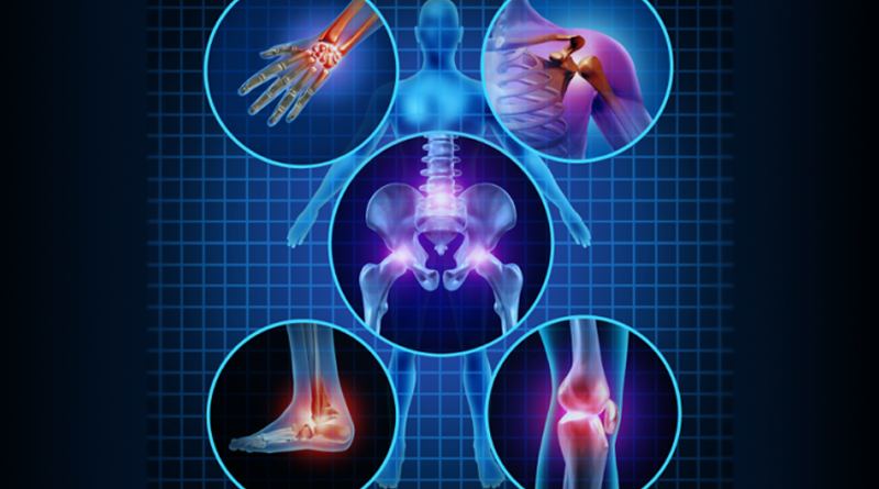 Thuốc chữa viêm khớp của mỹ loại nào tốt?