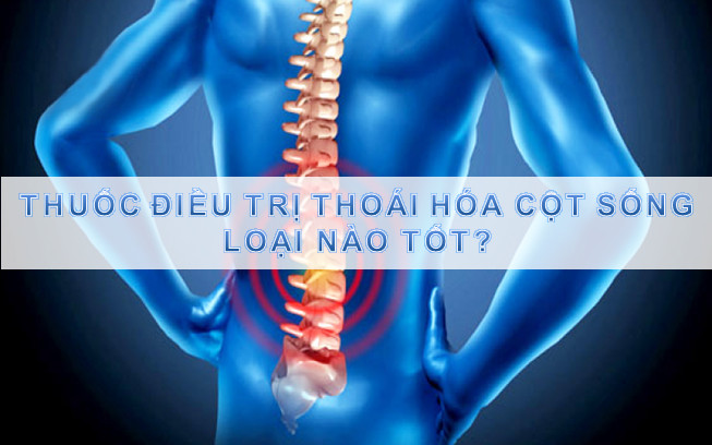 Thuốc hỗ trợ điều trị thoái hóa cột sống loại nào tốt 