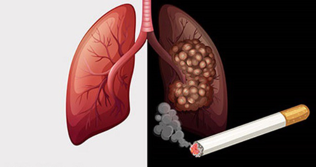 12 thói quen xấu ảnh hưởng tới phổi