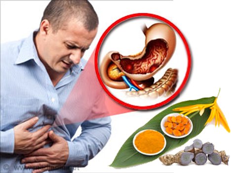 Thuốc tây chữa đau dạ dày loại nào tốt