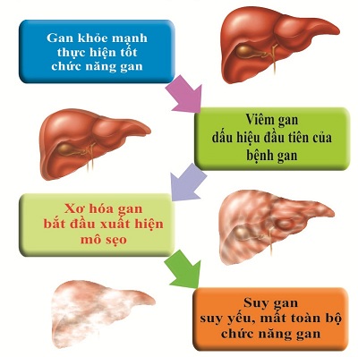 bệnh gan lây qua đường nào chủ yếu