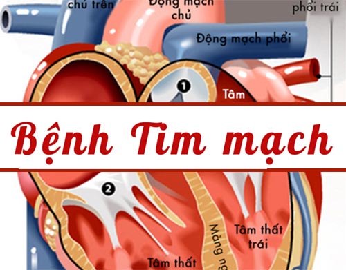 Tim đập nhanh và mạnh bất thường là bị làm sao