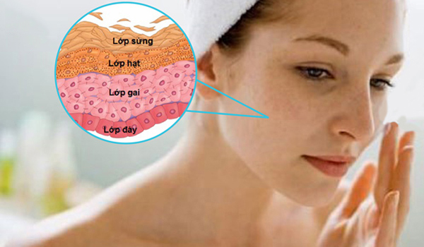 Trị nám tàn nhang bằng lá trầu không