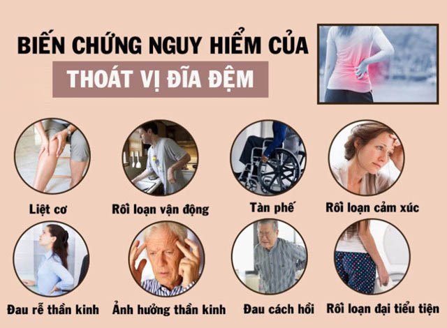 Triệu chứng của thoát vị đĩa đệm như thế nào