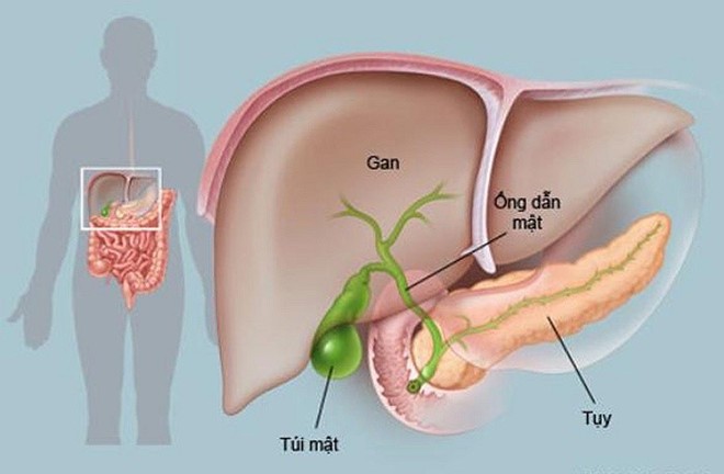 Triệu chứng của ung thư tuyến tụy là gì và cách phòng bệnh ra sao