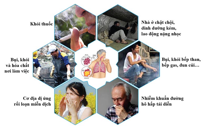 Triệu chứng viêm phế quản mãn tính