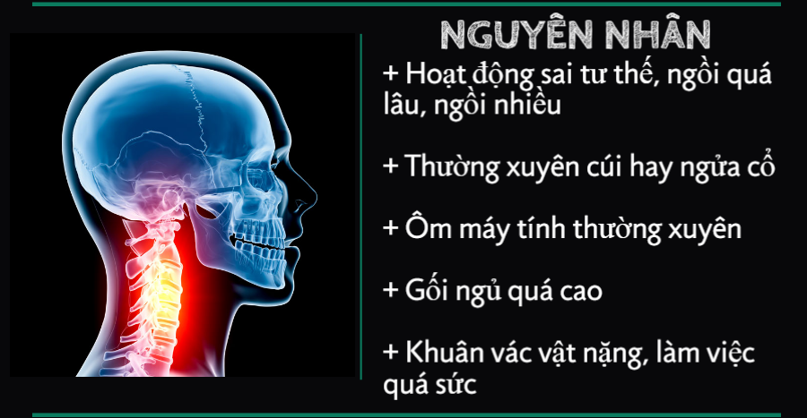 Tư thế nằm cho người thoái đốt sống cổ như thế nào