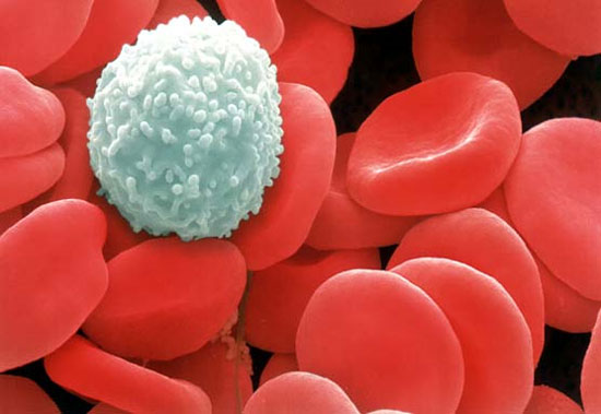 Ung thư máu có lây không và cách phòng bệnh