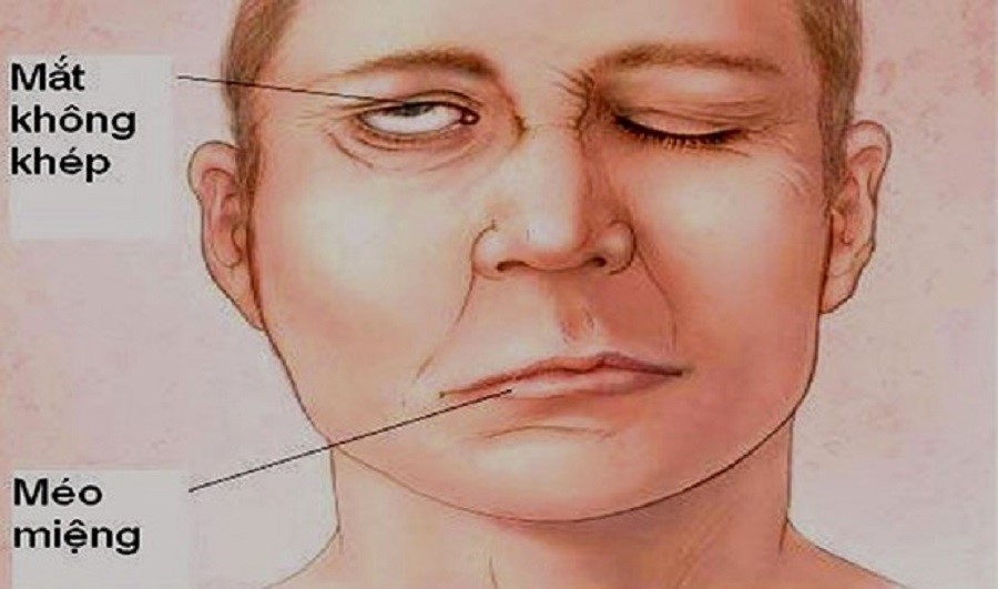 Uống lá bồ đề có tác dụng gì với sức khỏe con người