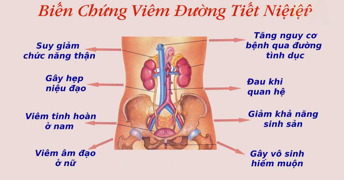 Viêm đường tiết niệu đau ở đâu