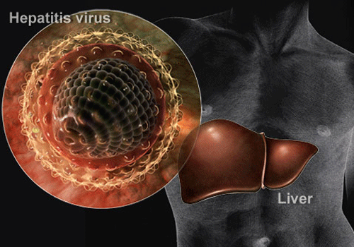 Viêm gan b có nguy hiểm không và cách phòng bệnh ra sao