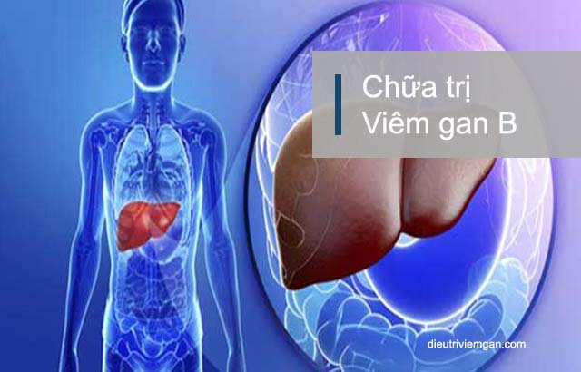 Viêm gan b mạn tính có chữa khỏi không