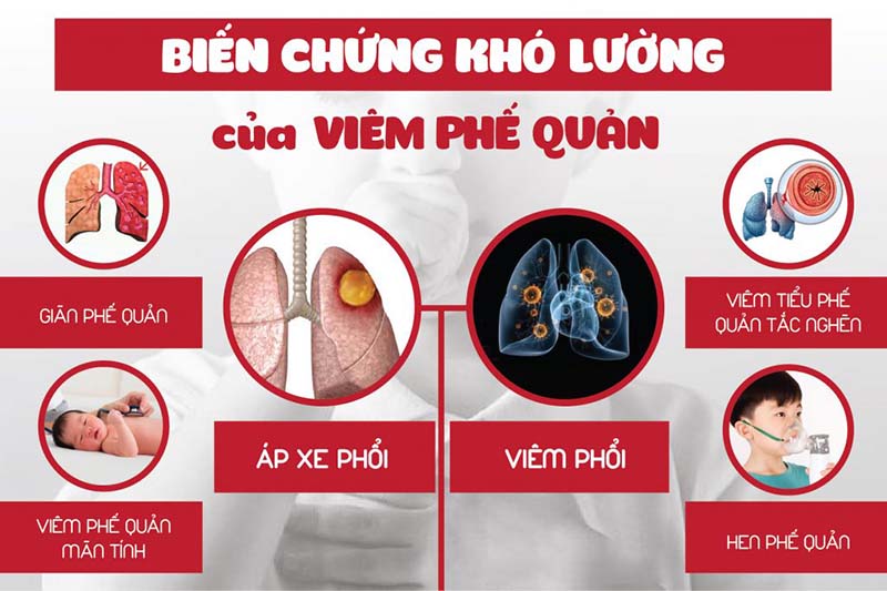 Viêm phế quản có nguy hiểm không và cách chăm sóc như thế nào