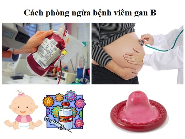 Virus viêm gan b lây qua đường nào và cách phòng bệnh ra sao