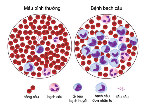 Xét nghiệm máu có thể biết được những bệnh gì