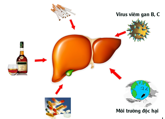 Xơ gan có biểu hiện như thế nào