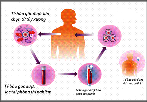 Xơ gan cổ trướng có chữa được không và cách phòng bệnh ra sao