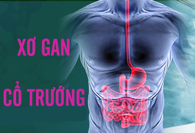 Xơ gan cổ trướng điều trị như thế nào