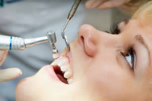 Lấy cao răng có hại gì không? Tác dụng của lấy cao răng?