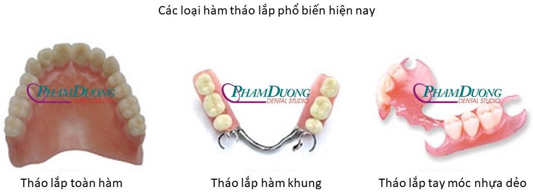 các loại hàm tháo lắp phổ biến