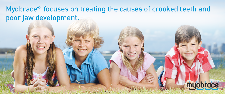 Chỉnh nha không mắc cài MyObrace - không gây đau đớn, thương tổn răng cho bé