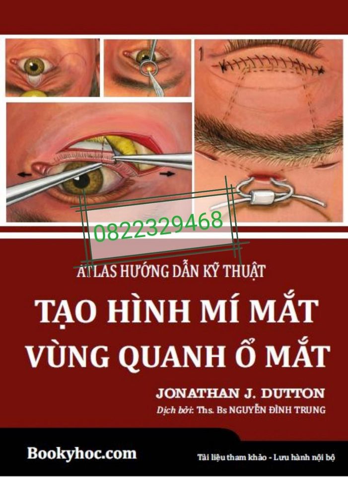 Sách nhãn khoa