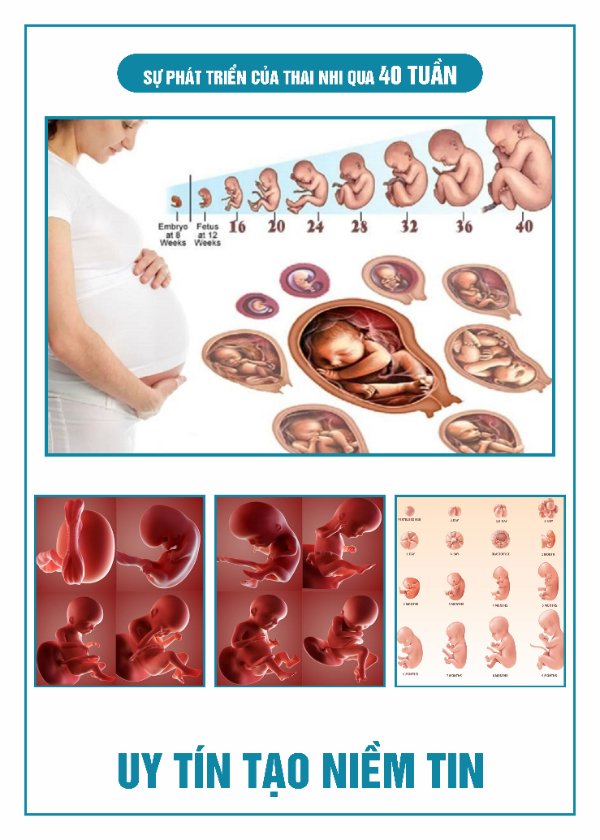 Tranh Chẩn Đoán Hình ảnh