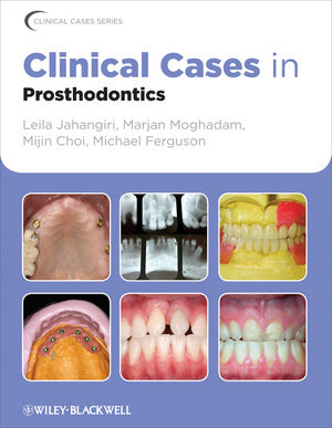 Sách cases in Prosthodontics - Wiley-Blackwell_ 1 edition